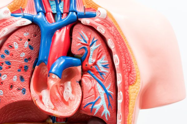 Test Simplu Poate Excluziona Tromboembolismul Pulmonar la Pacienții cu Cancer