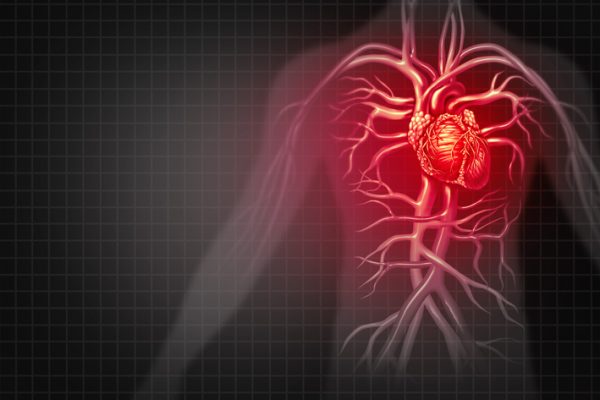Studiu: Reducerea riscului de evenimente cardiovasculare majore (MACE) în cazul pacienților cu risc crescut folosind medicament GLP-1