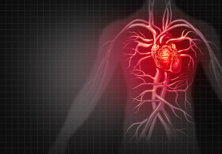 Studiu: Reducerea riscului de evenimente cardiovasculare majore (MACE) în cazul pacienților cu risc crescut folosind medicament GLP-1