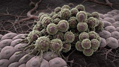 De ce oprirea genelor cancerului nu funcționează întotdeauna