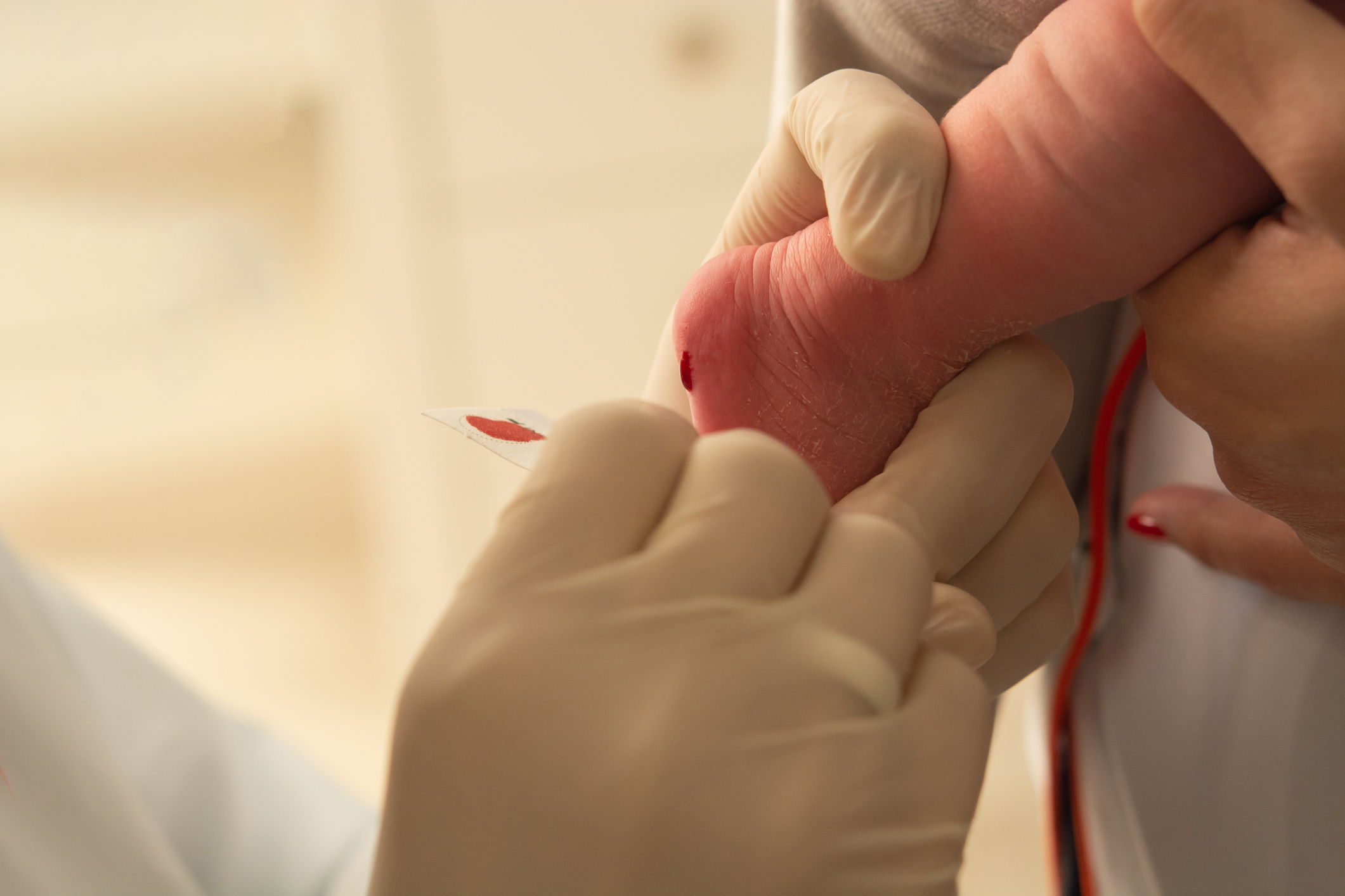 Depistarea Riscului de Cancer la Nou-Născuți Prin Screening Genetic Ar Putea Ajuta la Detectarea Timpurie a Riscului de Cancer