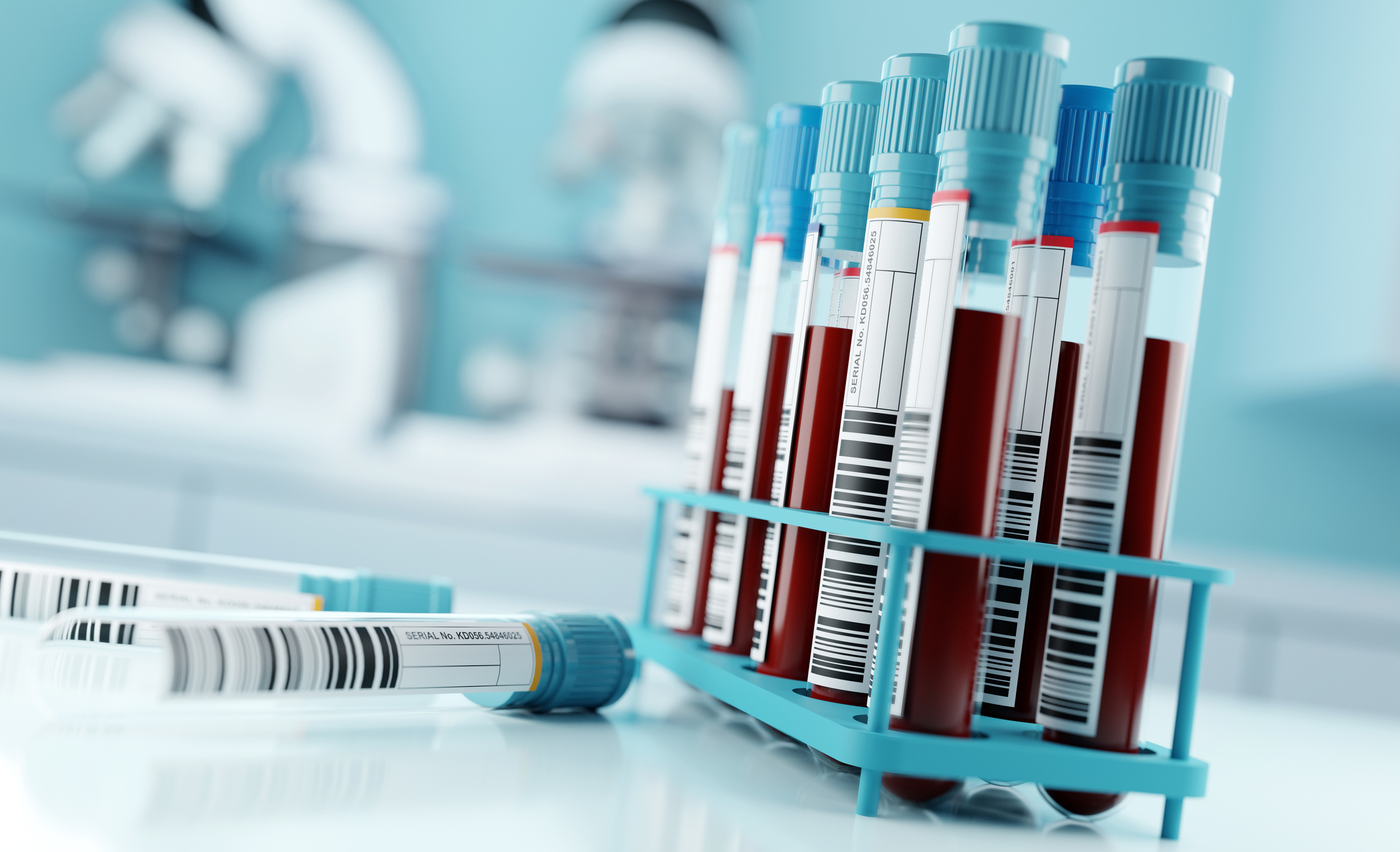 Testul sanguin FDA aprobat pentru Alzheimer marchează o schimbare către diagnosticarea mai timpurie și mai puțin invazivă