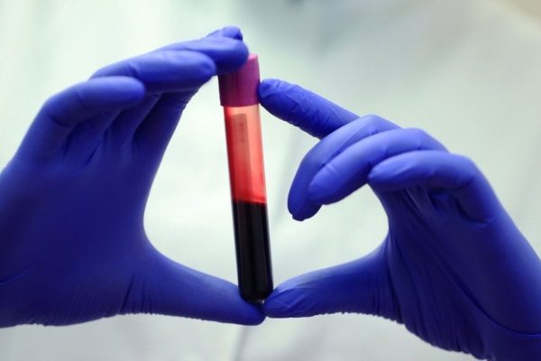 Oamenii care trăiesc peste 100 de ani au o Abundență Surprinzătoare de Celule Imune care Ucide Cancerul