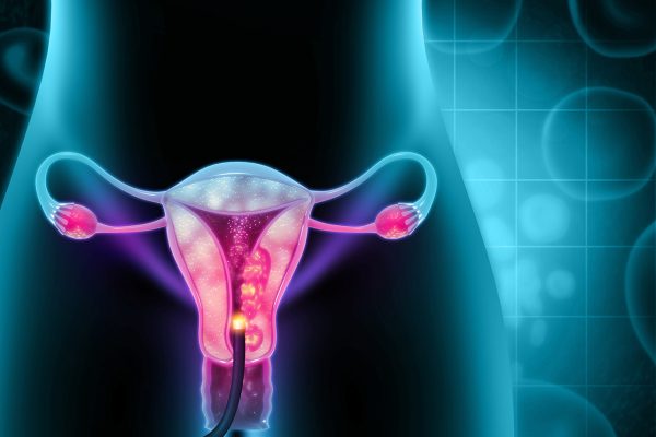 Bacteriile Specifice din Intestin Legate de Endometrioză
