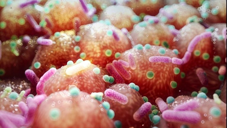 Legătura dintre boala Parkinson și bacteriile intestinale sugerează un tratament surprinzător de simplu