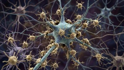 Microglia Consumă Neuroni Viabili în ALS, Confuzându-i cu Cei Morți