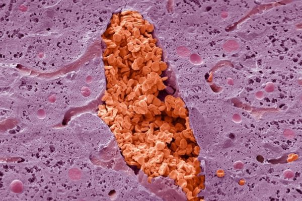 Misterul microscopului de luni: Ce este această ciudățenie roz și roșie?