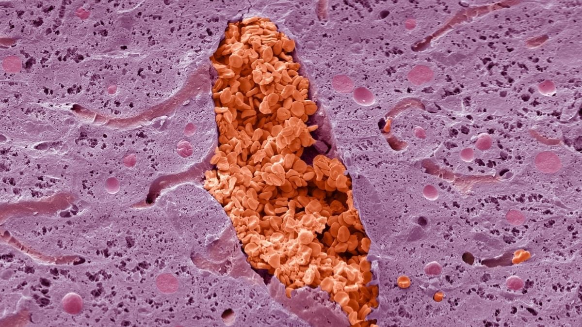 Misterul microscopului de luni: Ce este această ciudățenie roz și roșie?