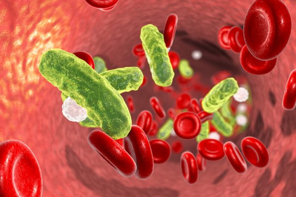 Testul de Cultură Sanguină la Nivel de Celule Singulare Reduce Diagnosticul Sepsei de la Zile la Ore