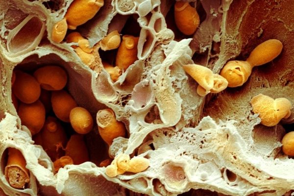 Descoperirea unui posibil tratament pentru infecțiile fungice letale și rezistente la medicamente