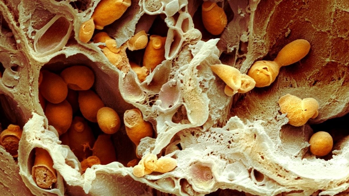 Descoperirea unui posibil tratament pentru infecțiile fungice letale și rezistente la medicamente