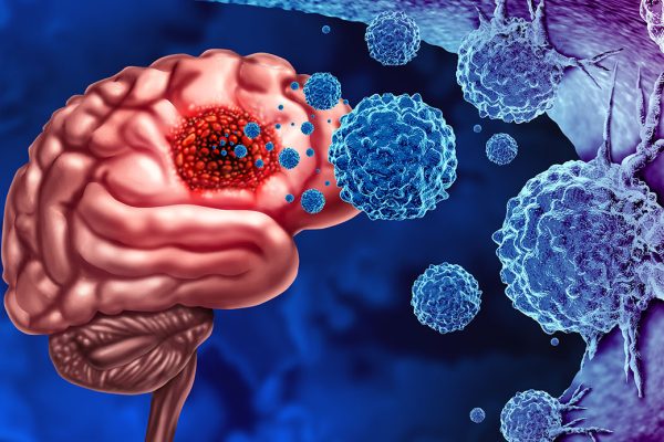 Cum Neuroni Inhibitori Pot Controla Tumorile Cerebrale Gliomatoase la Adulți