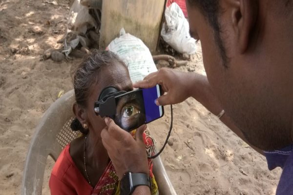 Dispozitive de Atașare pentru Smartphone-uri pentru Cataractă în Comunitățile Rurale