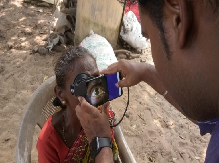 Dispozitive de Atașare pentru Smartphone-uri pentru Cataractă în Comunitățile Rurale