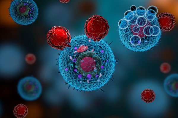 Cum Tumorile Folosesc o Proteină Antioxidantă pentru a Inactiva Celulele T Care Luptă împotriva Cancerului