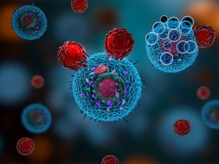 Cum Tumorile Folosesc o Proteină Antioxidantă pentru a Inactiva Celulele T Care Luptă împotriva Cancerului