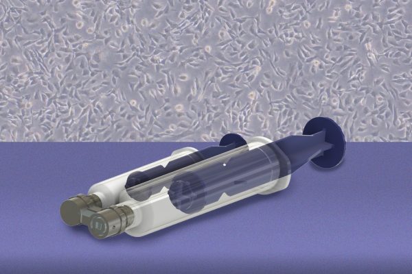 Dispozitivul MIT pentru Detectarea mai Timpurie a Cancerului Ovarian