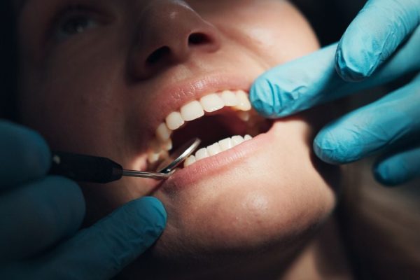 Legătura dintre Problemele Comune cu Gingiile și un Risc Mai Mare de 61% de Alzheimer