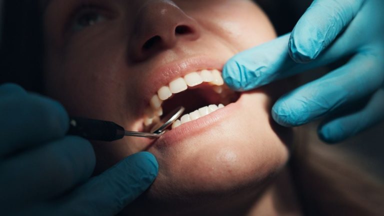 Legătura dintre Problemele Comune cu Gingiile și un Risc Mai Mare de 61% de Alzheimer