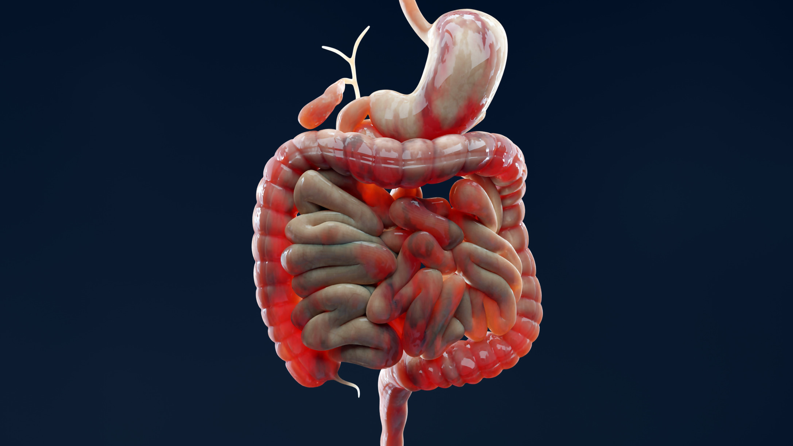 De ce continuă să se manifeste boala inflamatorie intestinală? Cercetătorii au găsit o pistă în mucoasa intestinală