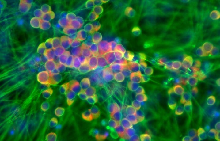 Peptid experimental reduce semnalele de durere cronică păstrând durerea protectoare
