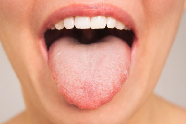 Cum sunt legate bacteriile din gură de viteza cu care gândești